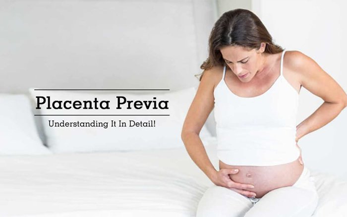 placenta previa symptoms