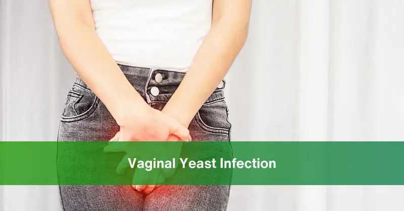 Vaginal Yeast Infection