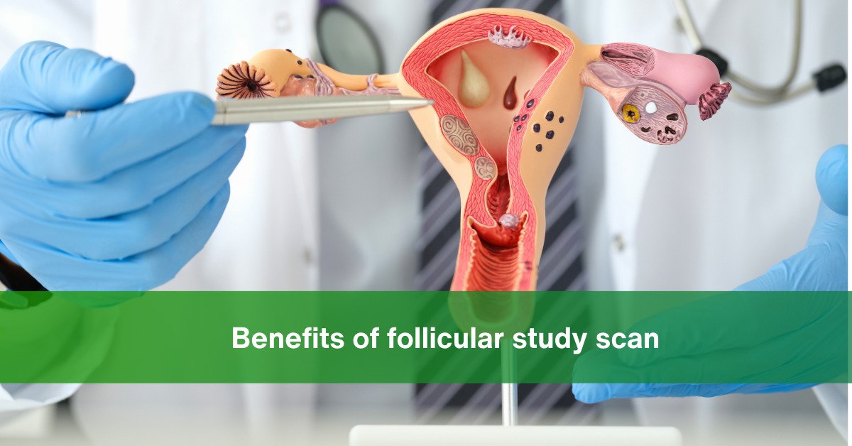 Benefits of Follicular Study Scan