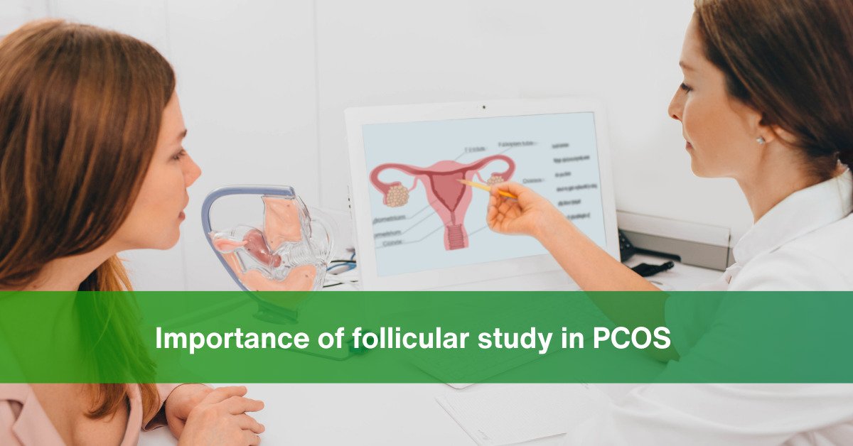 Importance of Follicular Study in PCOS