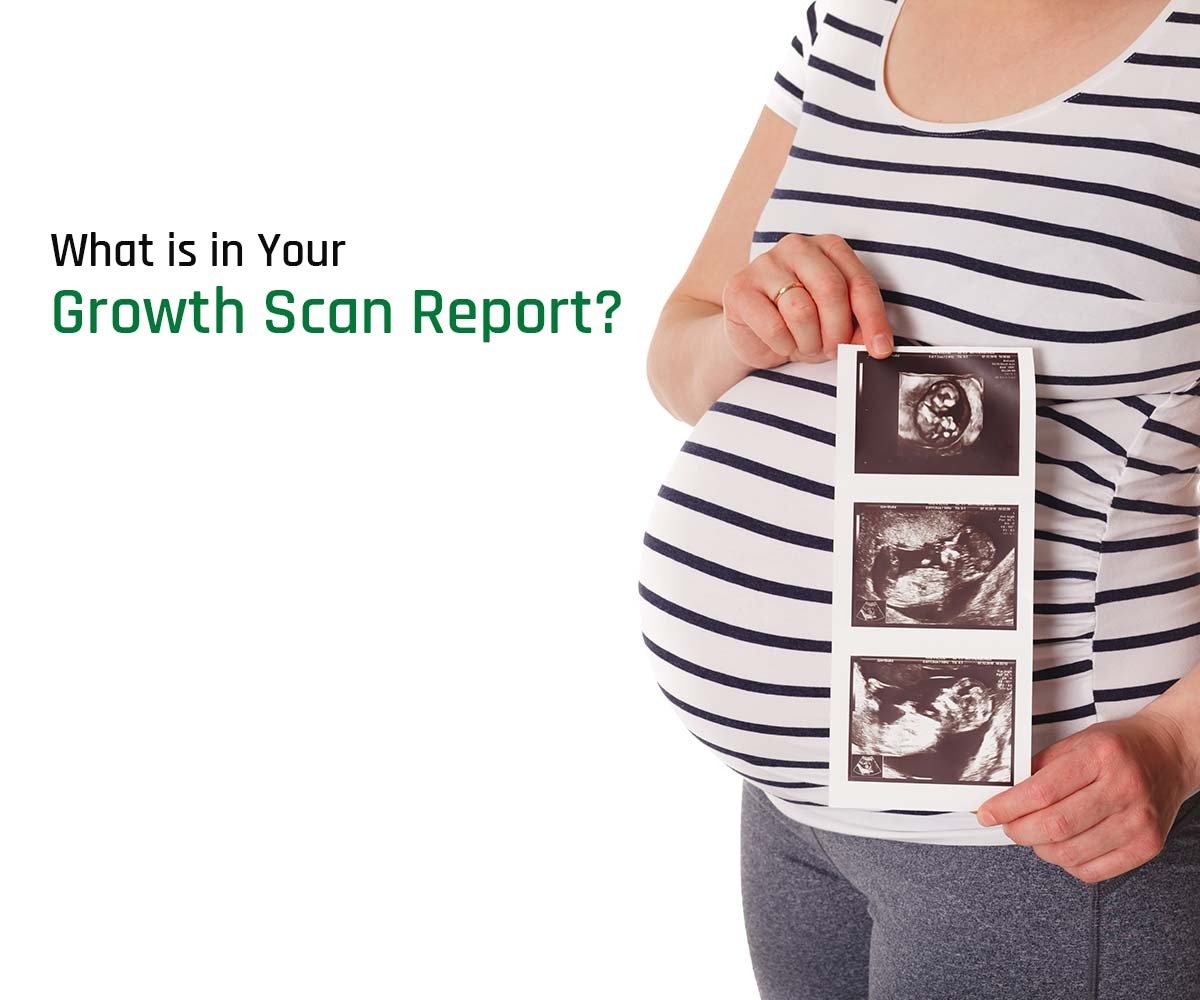 Growth Scan Report