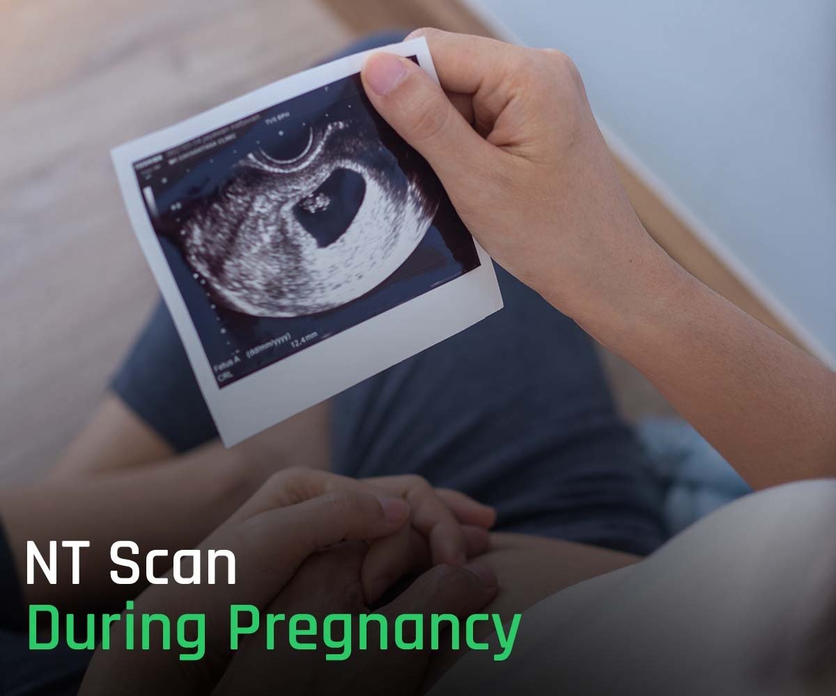 NT Scan During Pregnancy