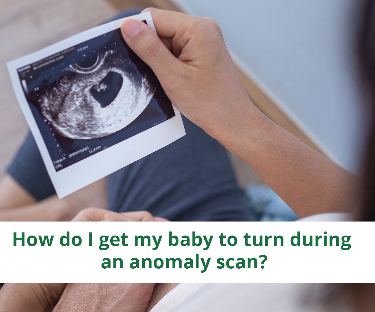 How do I get my baby to turn during an anomaly scan