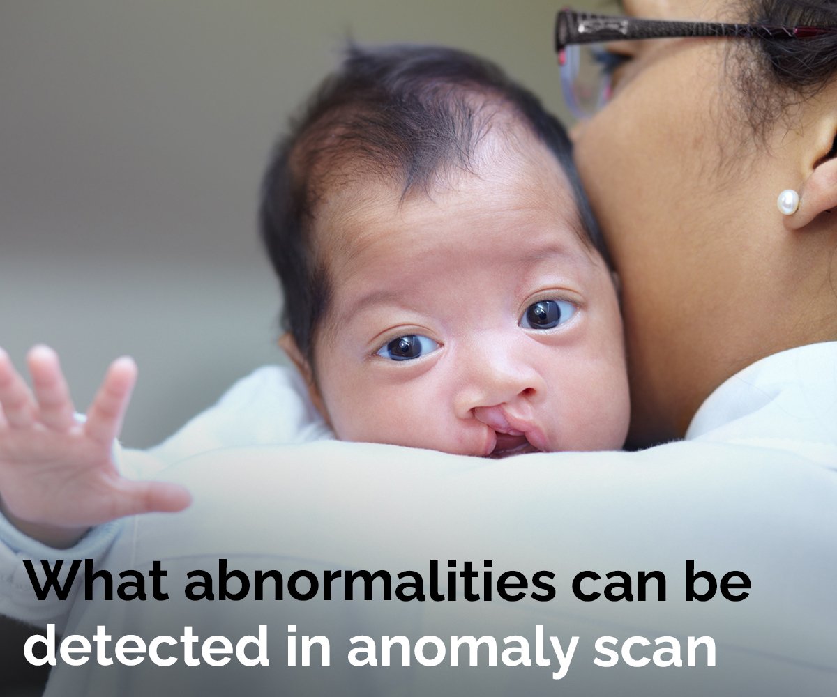 What abnormalities can be detected in anomaly scan