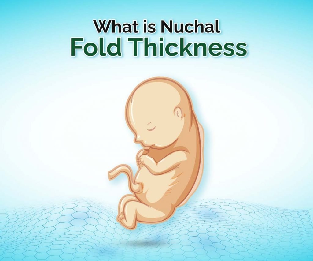 What is Nuchal Fold Thickness