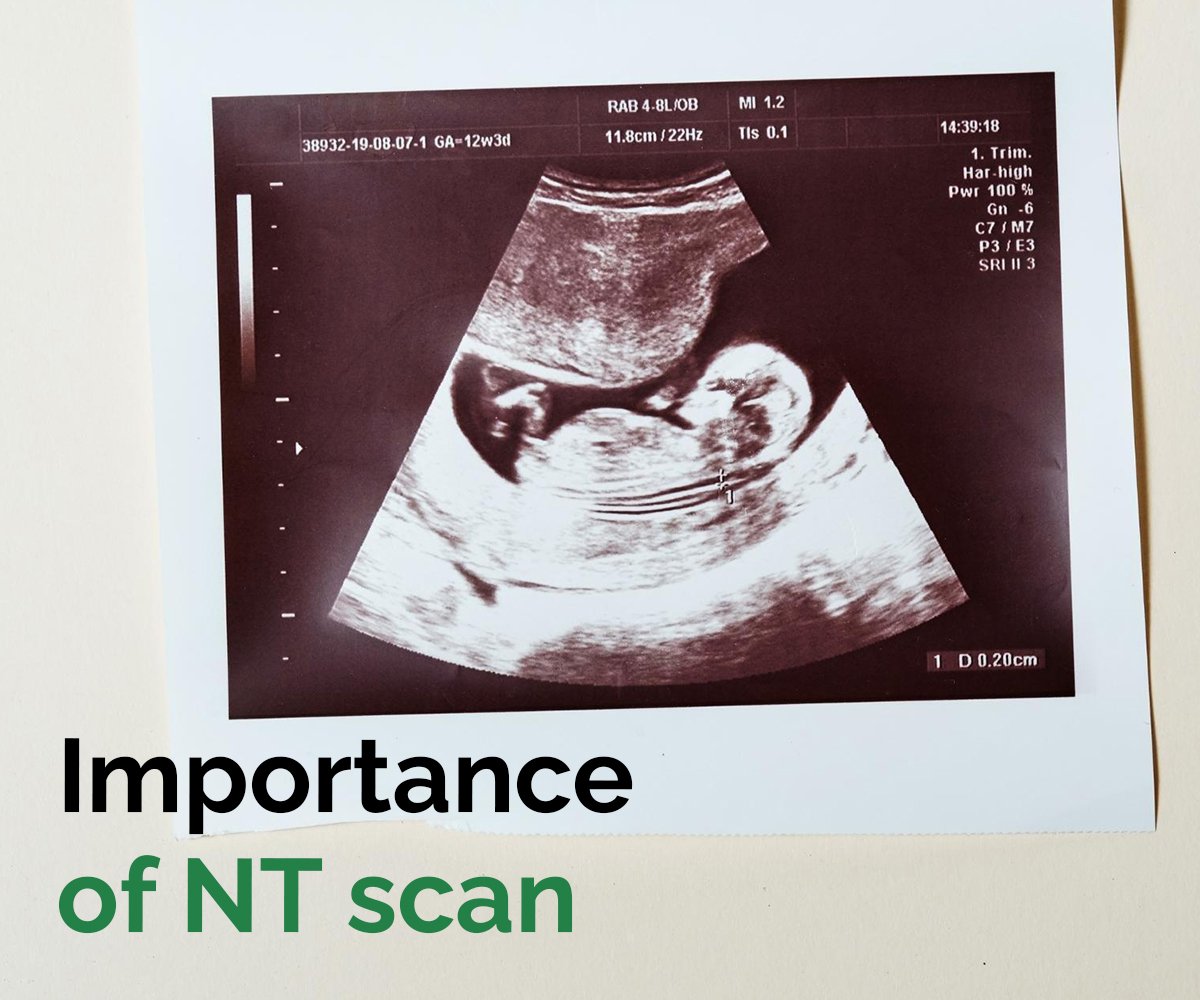 importance of NT scan