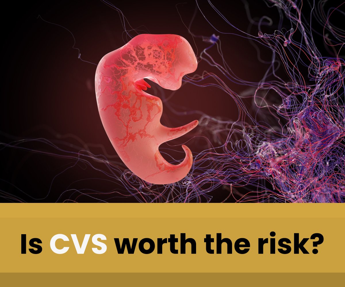 Is CVS worth the risk