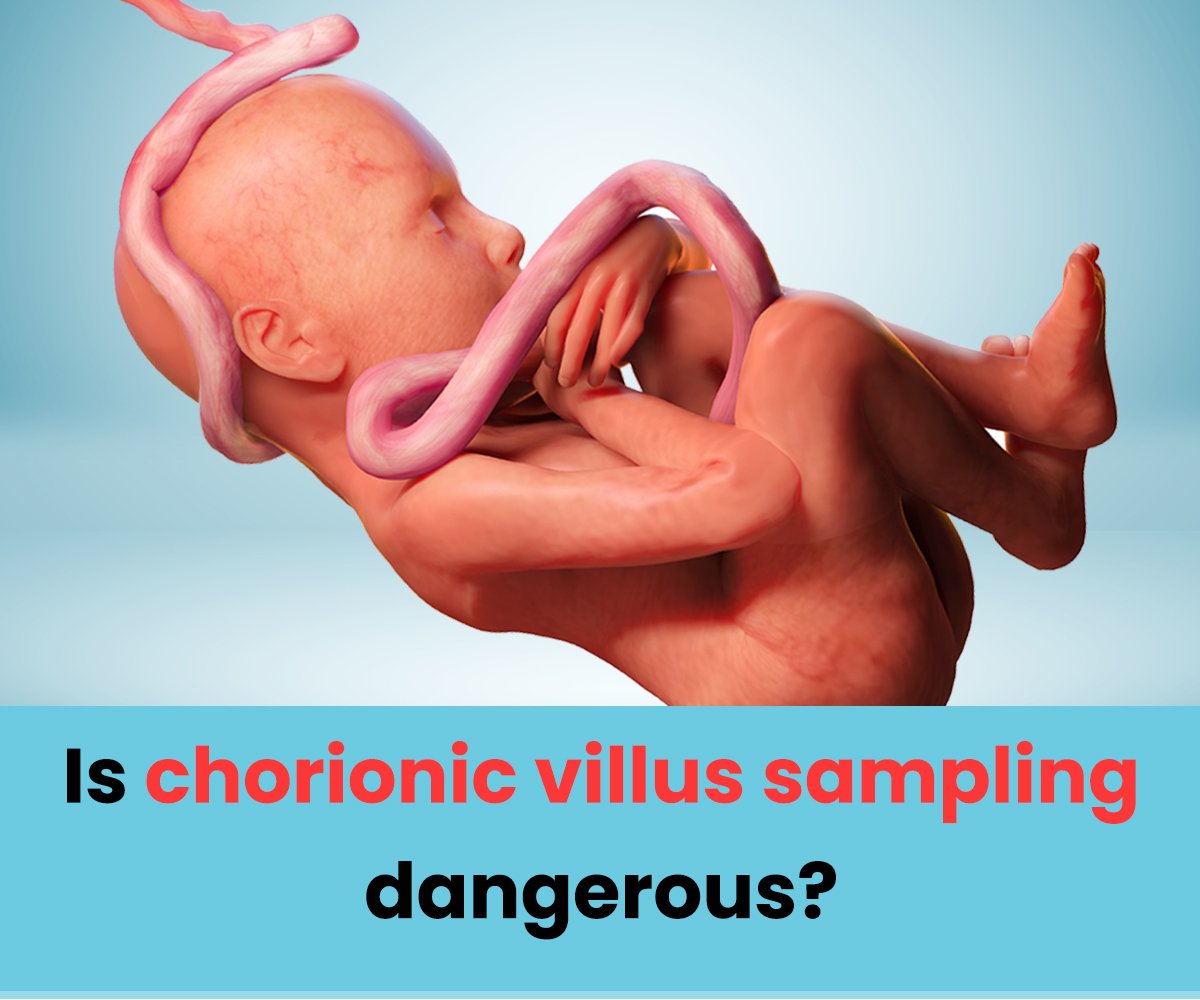 Is chorionic villus sampling dangerous