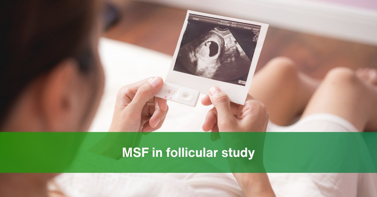 msf in follicular study