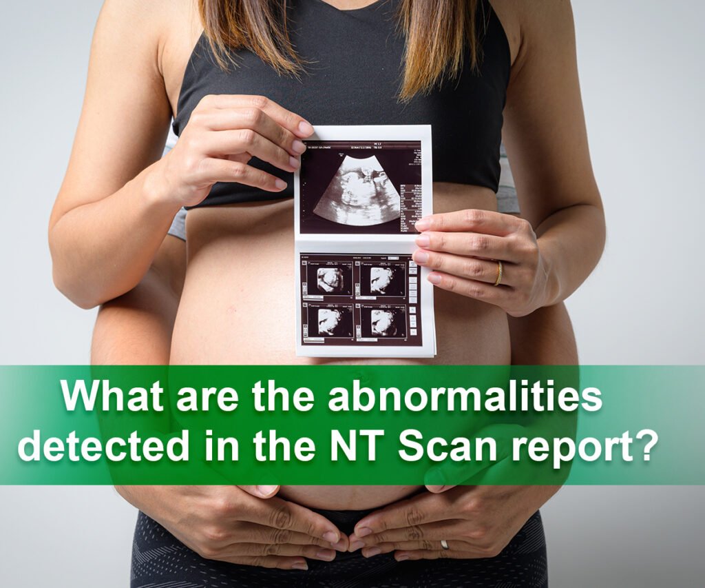 What are the abnormalities detected in the NT Scan report