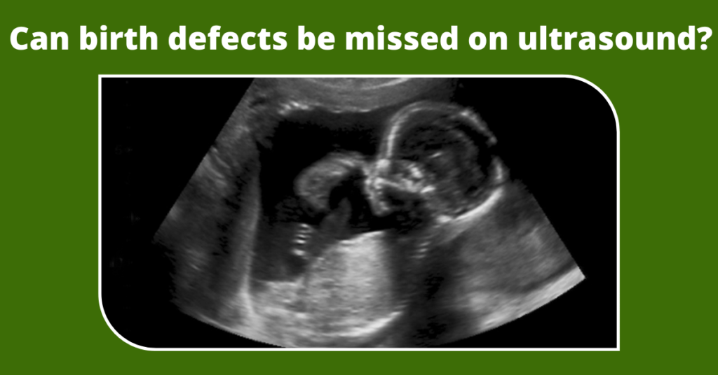 can birth defects be missed on ultrasound