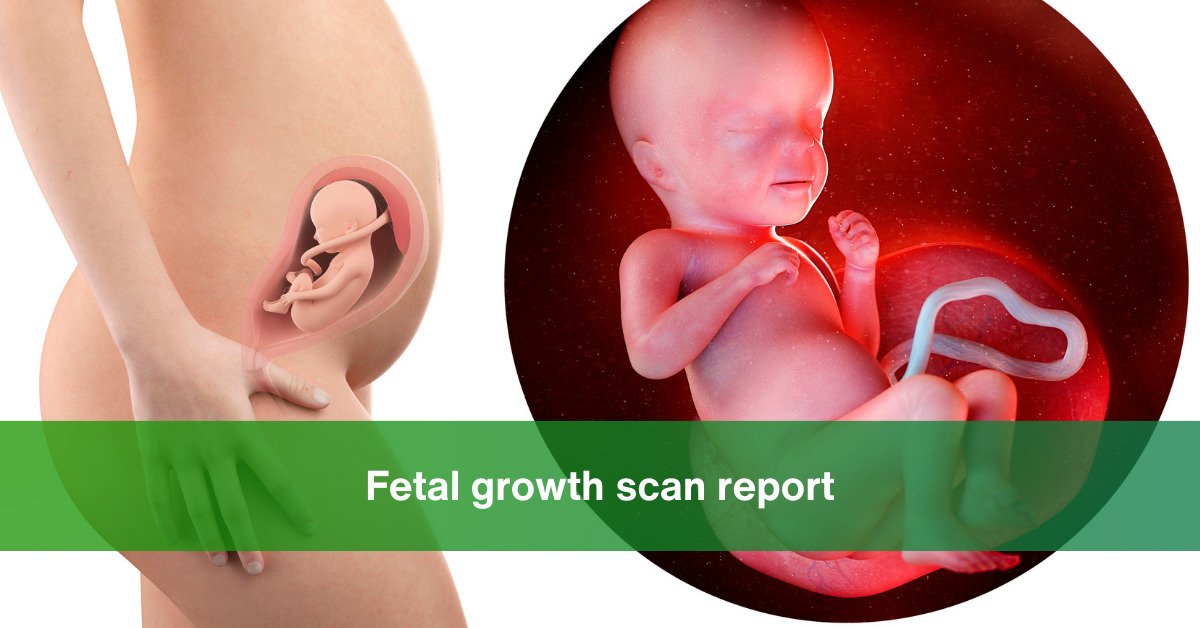 fetal growth scan report