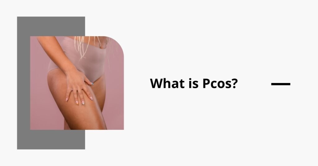 what is pcos