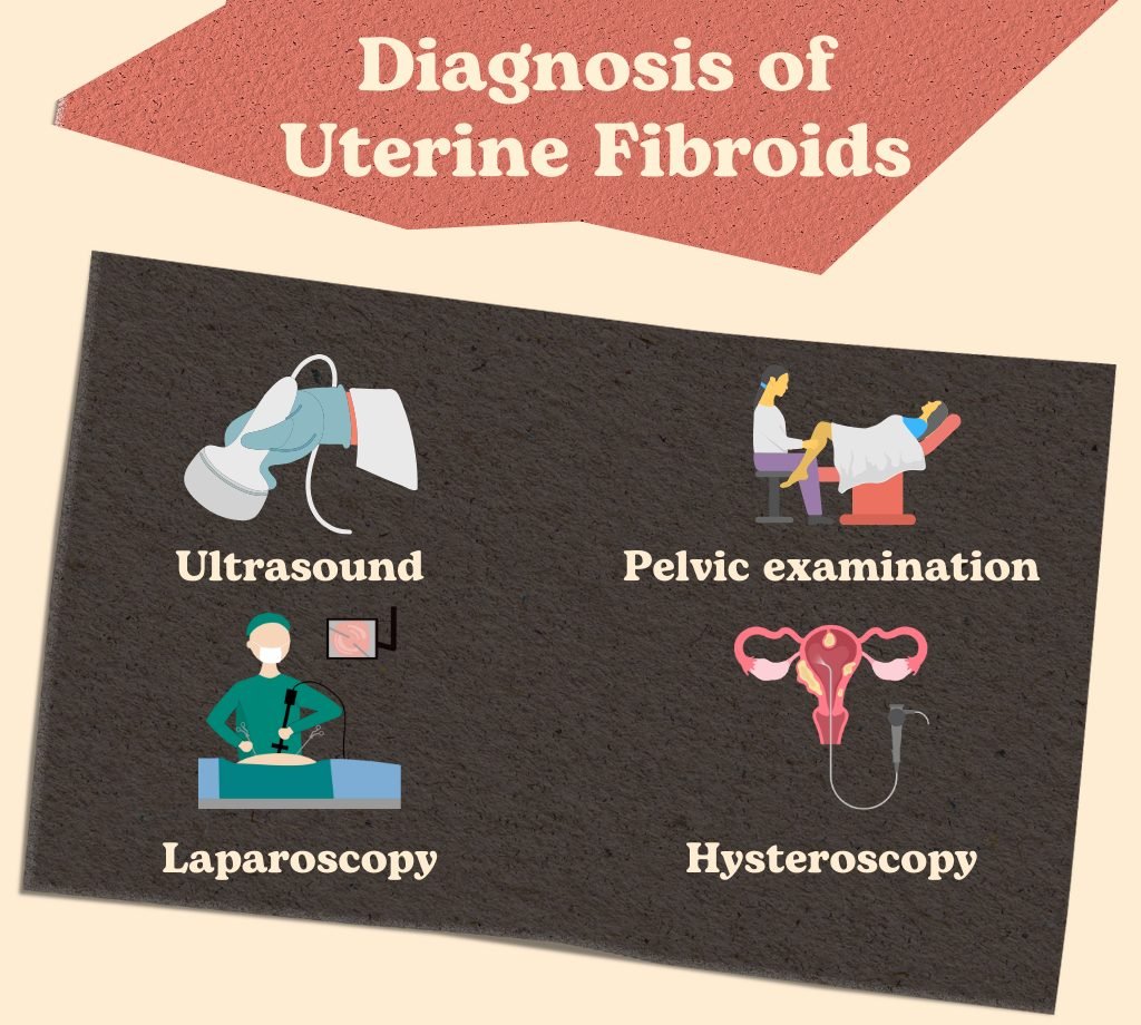 diagnosis of uterine fibroids