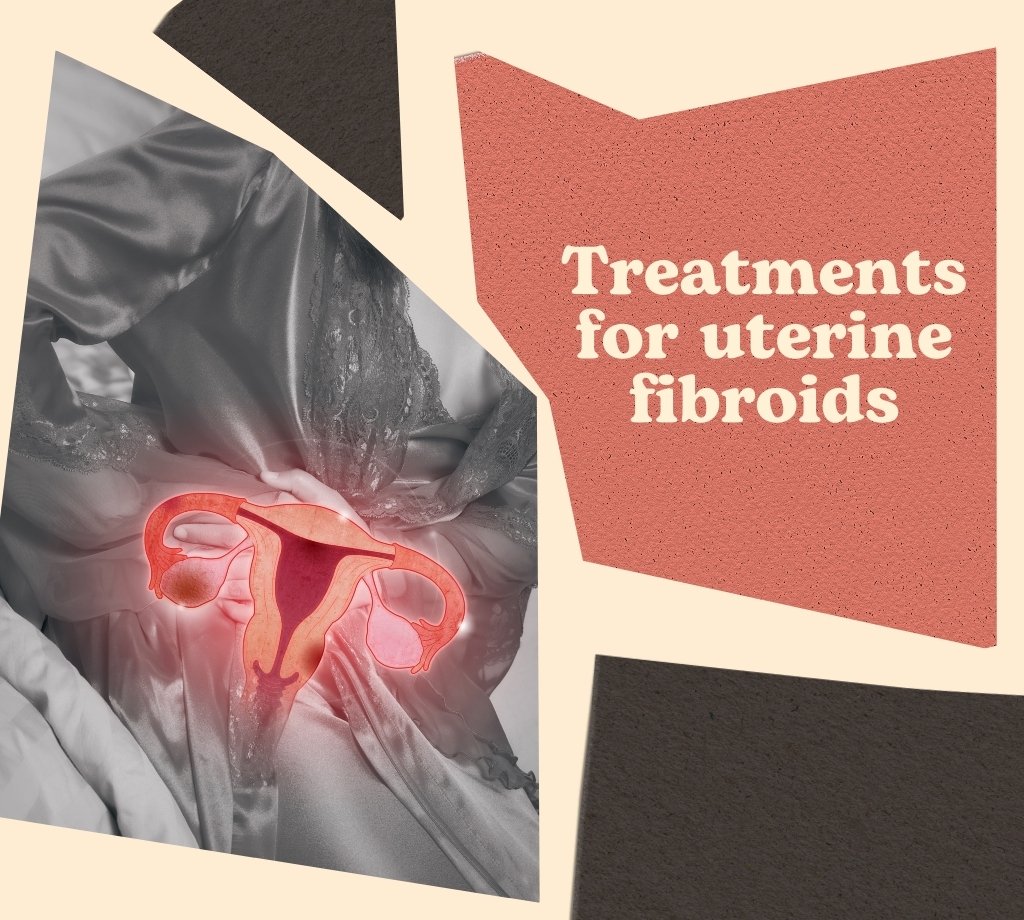 treatments for uetrine fibroids