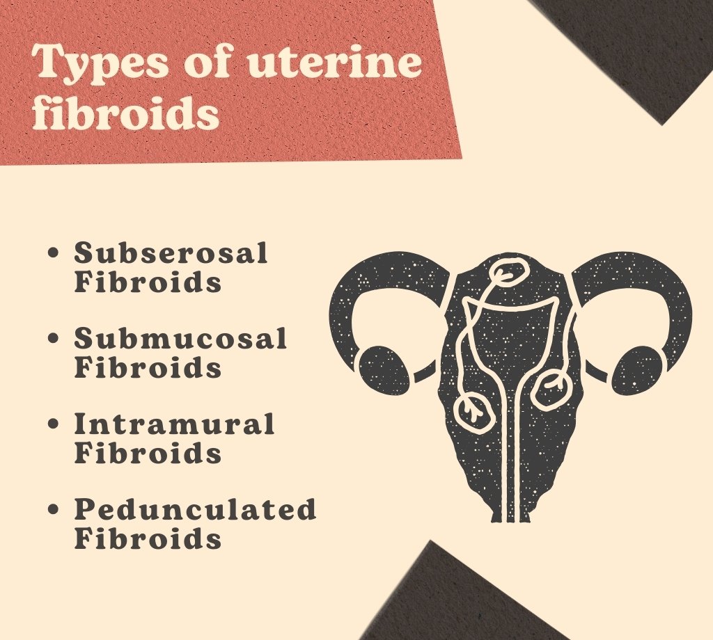 types of uterine fibroids