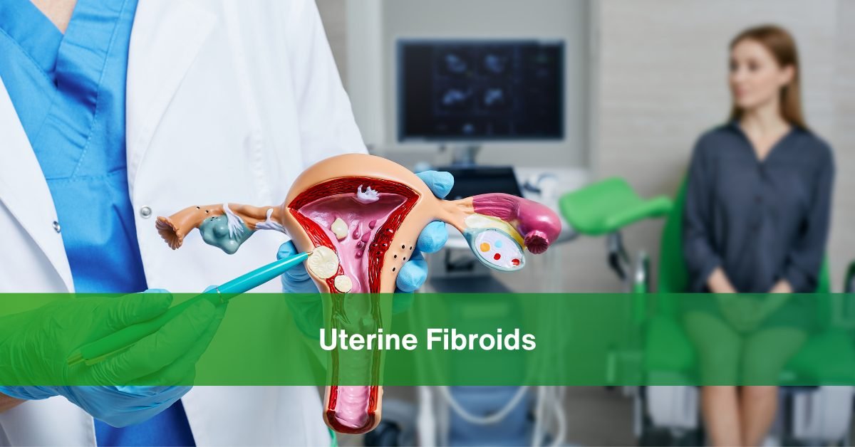 uterine fibroids