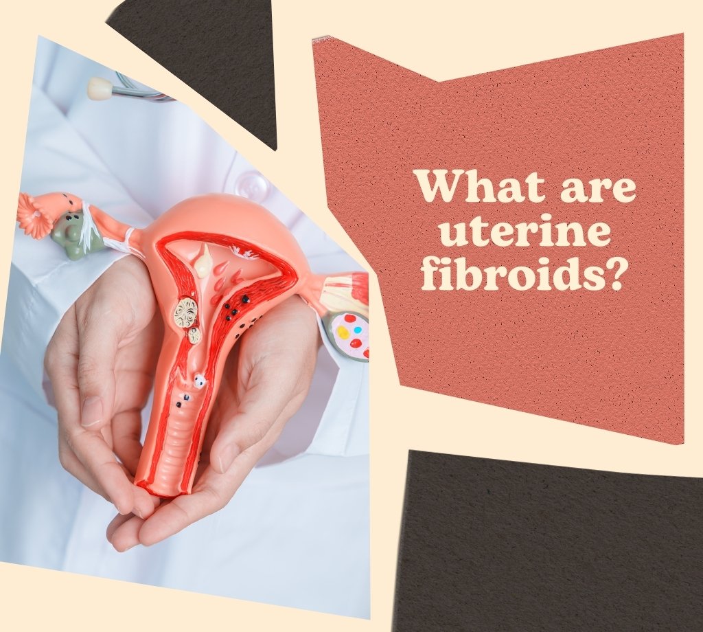 what are uterine fibroids