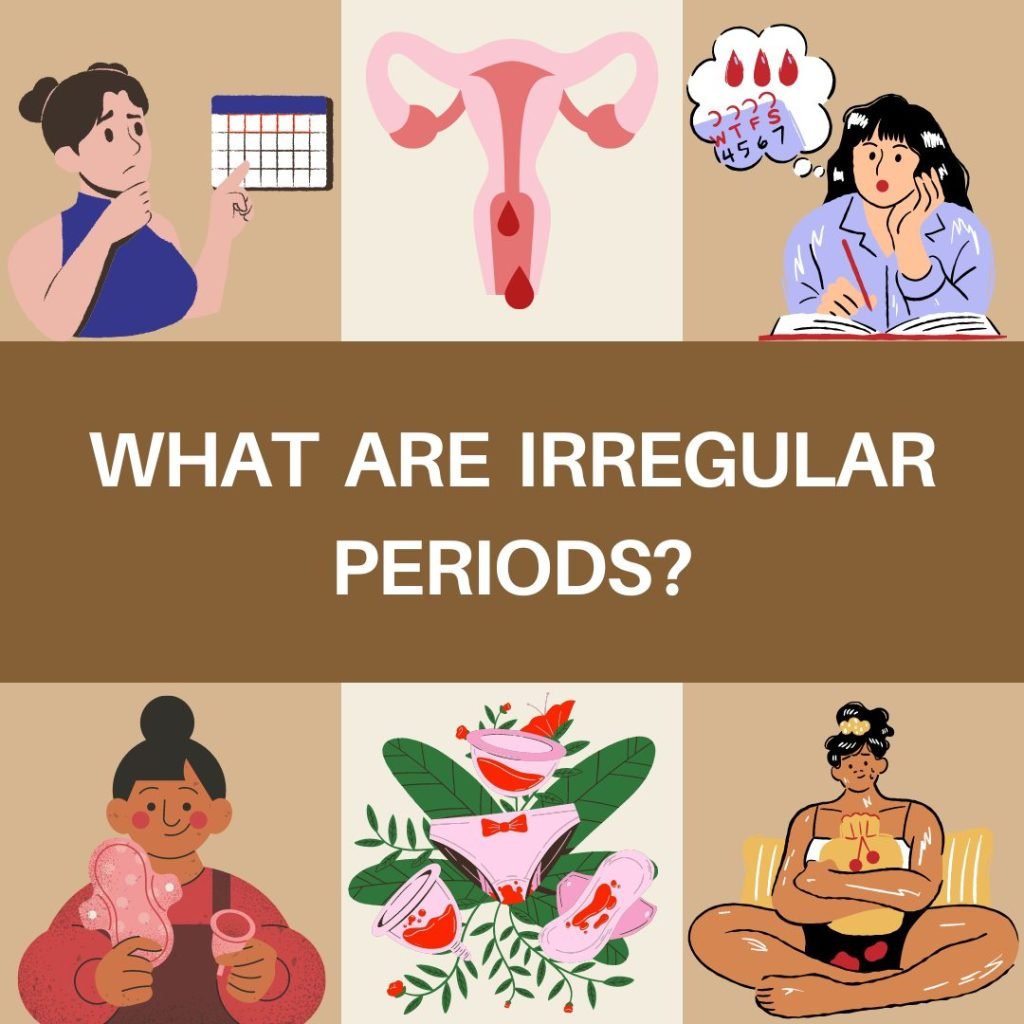 What are irregular periods