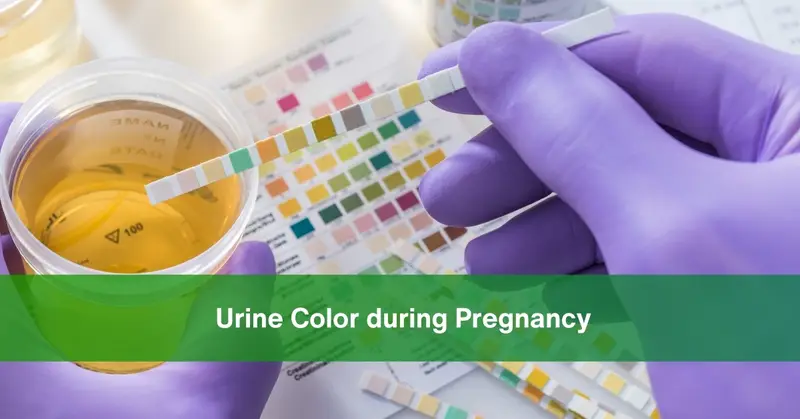 urine color during pregnancy time