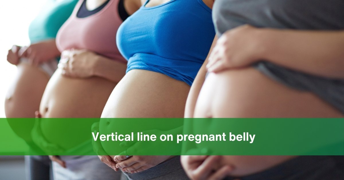 vertical line on pregnancy belly