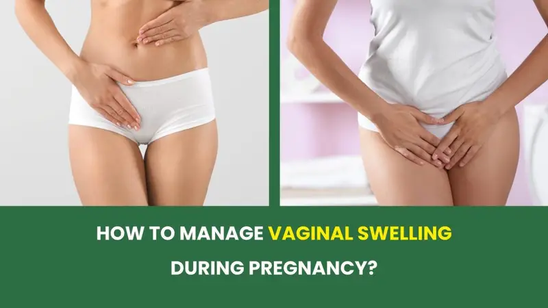 How to manage vaginal swelling during pregnancy