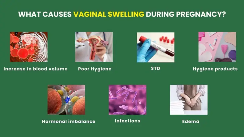 What causes vaginal swelling during pregnancy