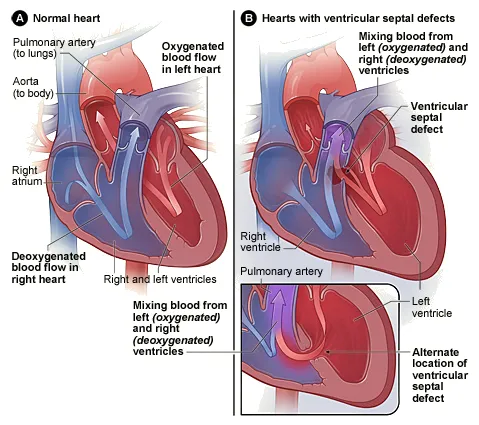 Fetal-Echocardiogram