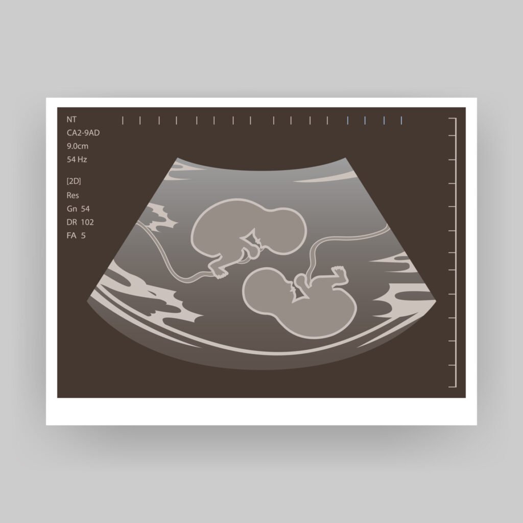 Twins in Scan