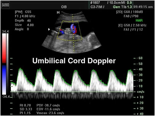 fetal-doppler-scans