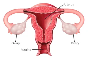 pelvic-scan