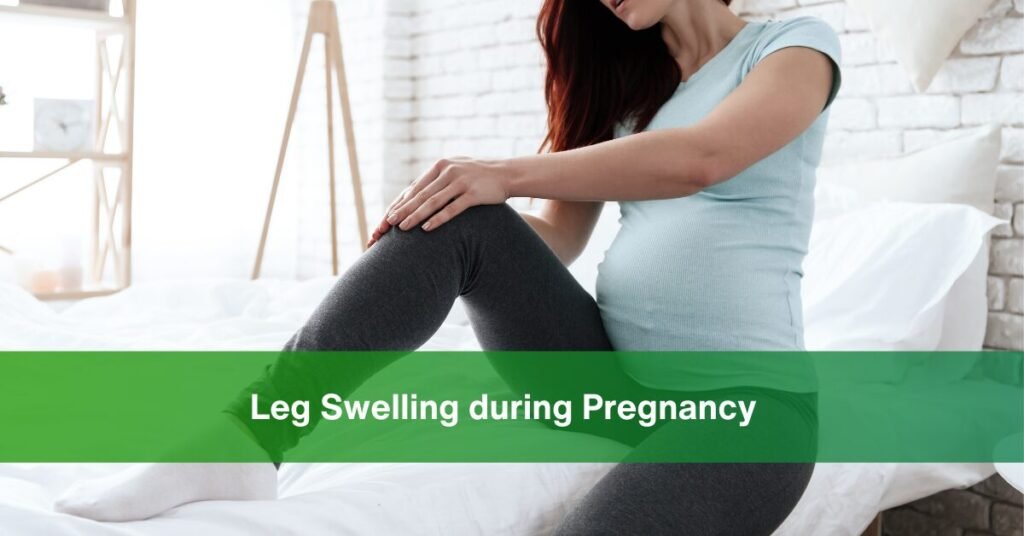 Leg Swelling during Pregnancy