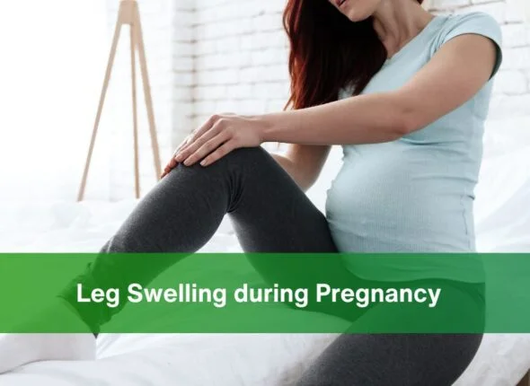 Leg Swelling during Pregnancy